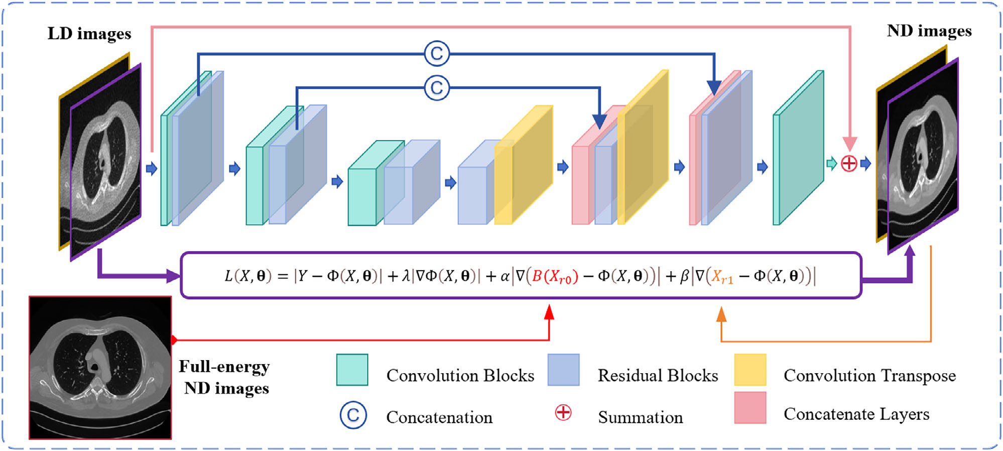 SP-Net：基于结构先验网络的低剂量能谱CT重建